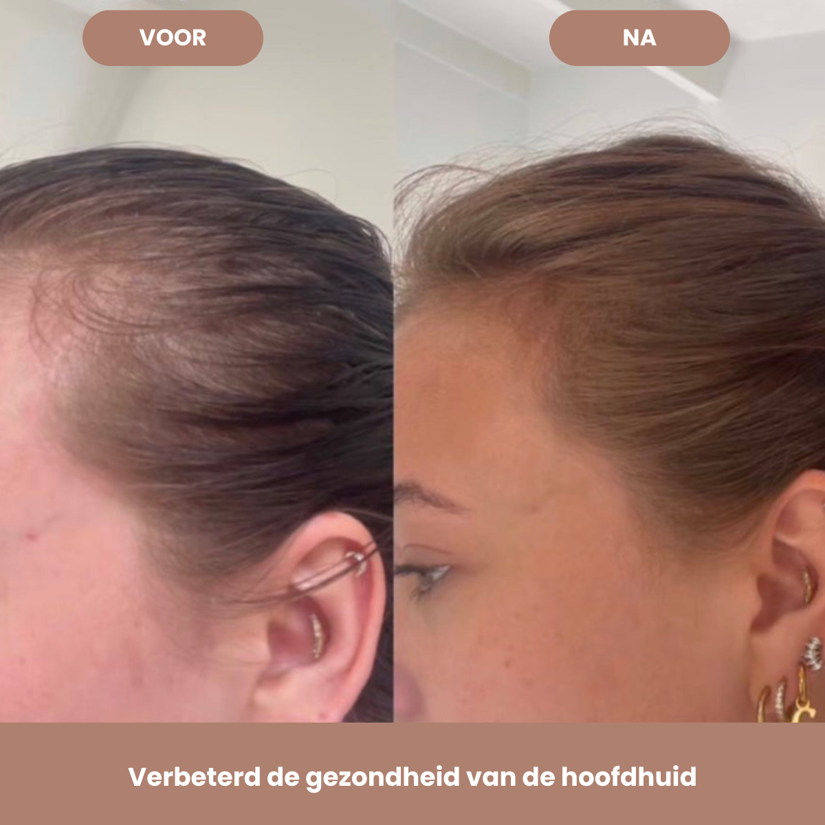 Forest & Shore - Natuurlijke Haarolie Voor Volume en Groei