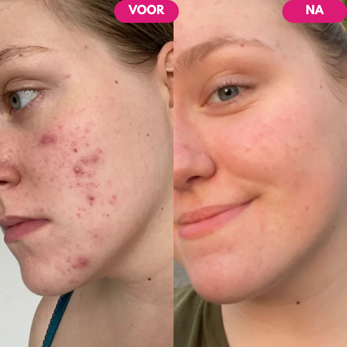 Lumora™ Vitamine C Elixir voor een Heldere, Egale Huid