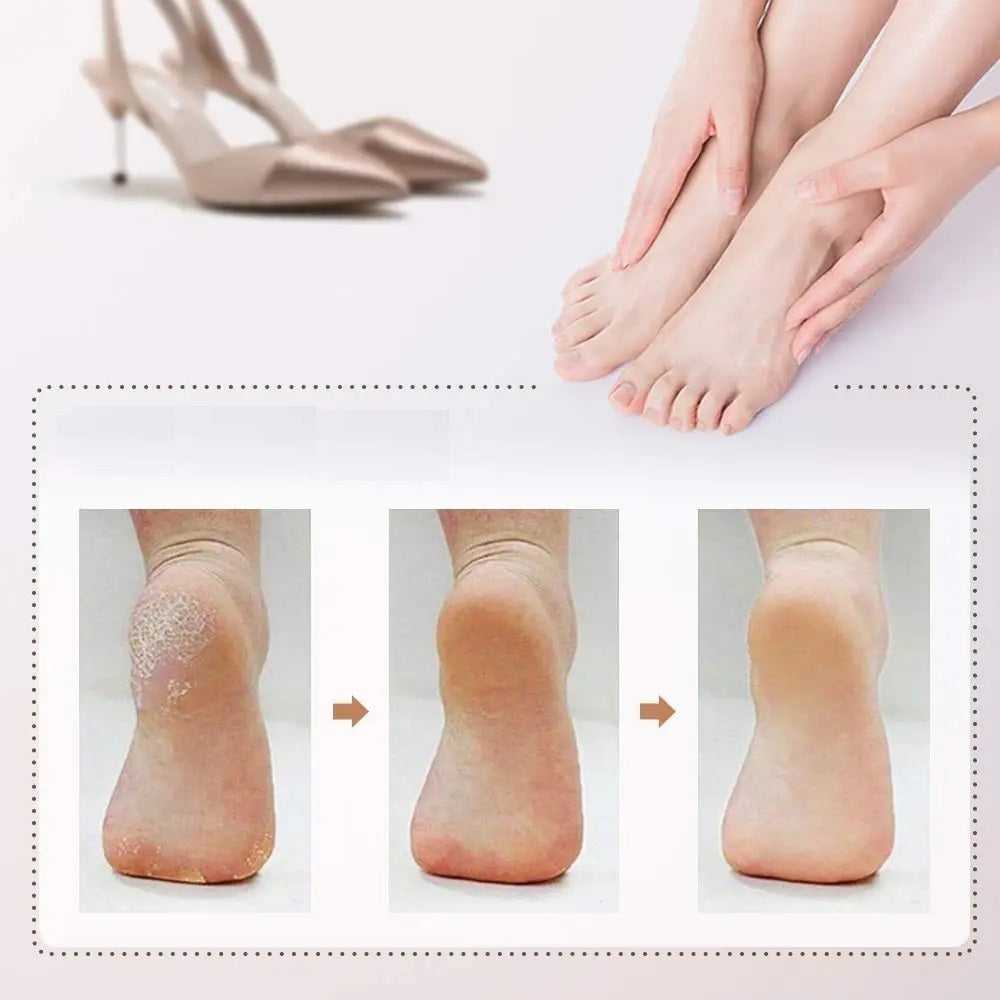 SoleSweep™ | Zachte, pijnvrije voeten