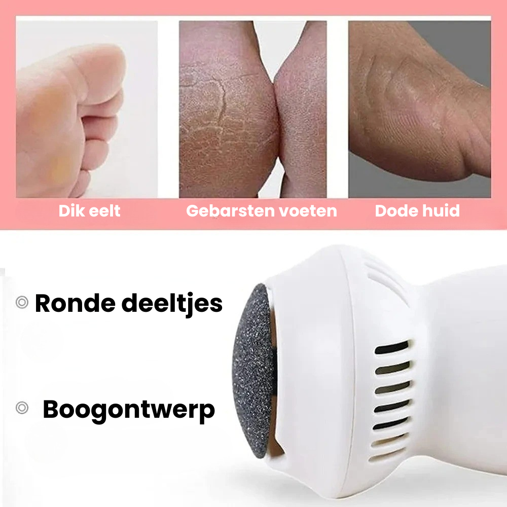 SoleSweep™ | Zachte, pijnvrije voeten