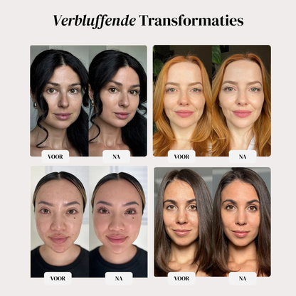 Monets TLM - Changing Foundation