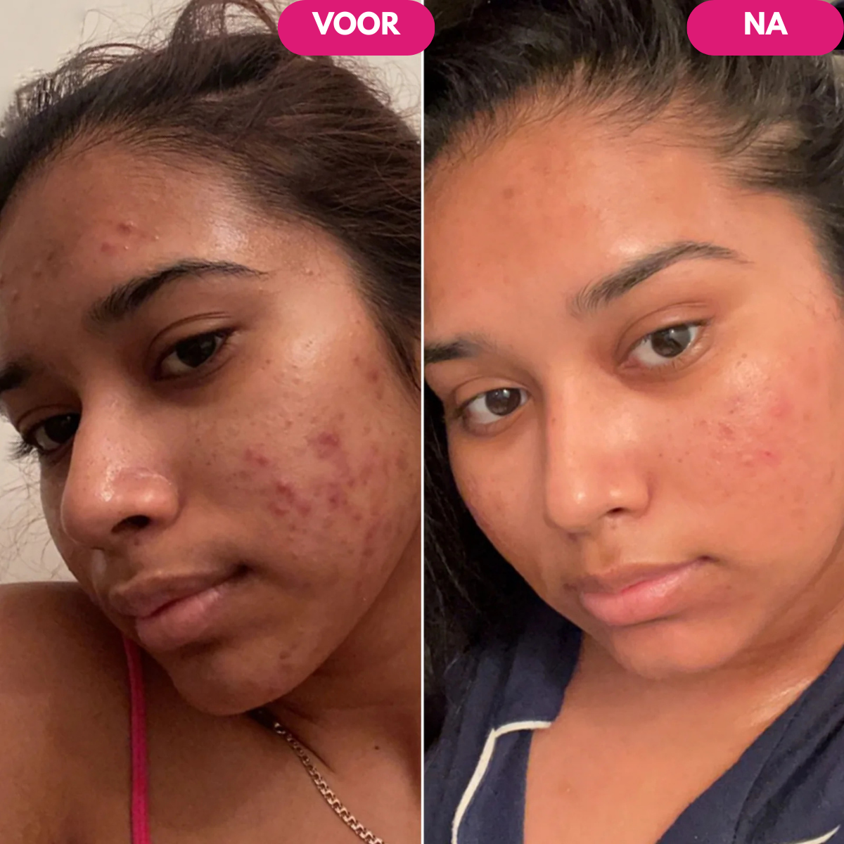 Lumora™ Vitamine C Elixir voor een Heldere, Egale Huid