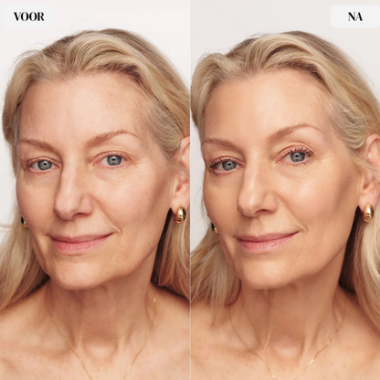 Monets TLM - Changing Foundation