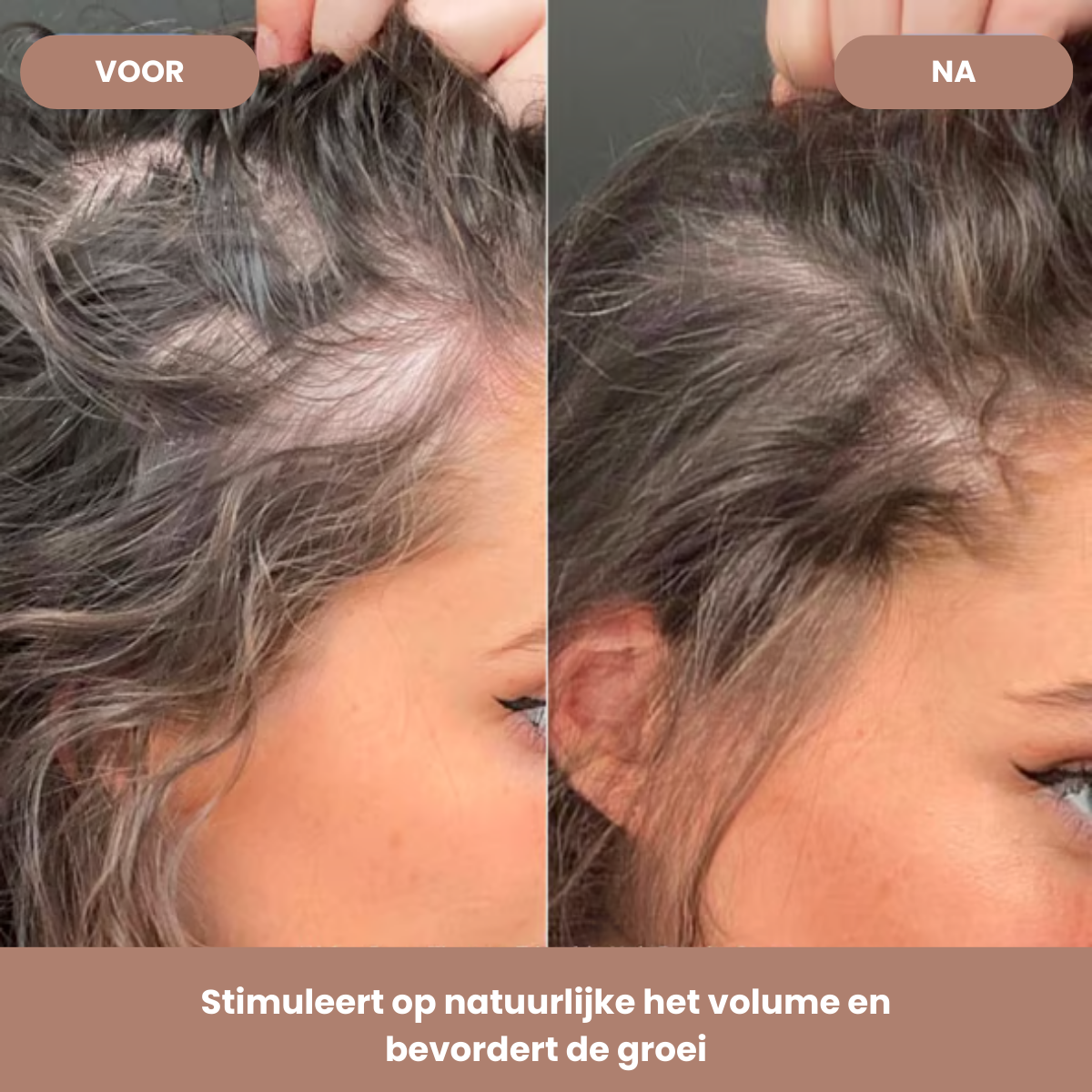 Forest & Shore - Natuurlijke Haarolie Voor Volume en Groei