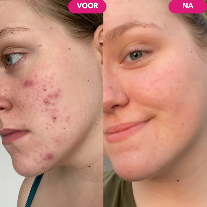 Lumora™ Vitamine C Elixir voor een Heldere, Egale Huid