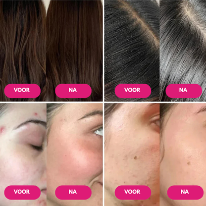 PureSpa™ Douchefilter - Voor een zachte huid en stralend haar