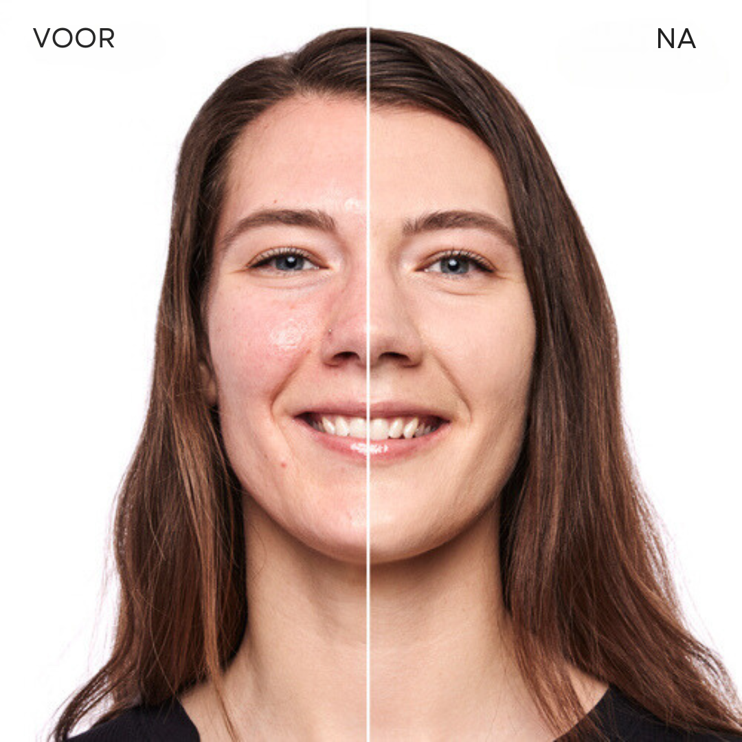 LuxeTone™ | Geen onrustige huid meer!