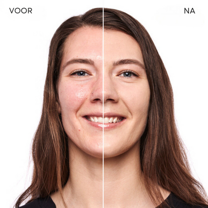 LuxeTone™ | Geen onrustige huid meer!