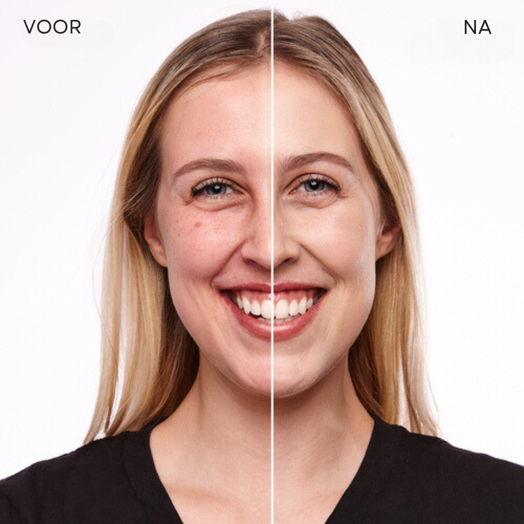 LuxeTone™ | Geen onrustige huid meer!