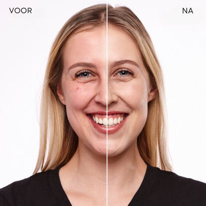 LuxeTone™ | Geen onrustige huid meer!