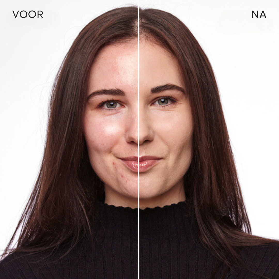 LuxeTone™ | Geen onrustige huid meer!