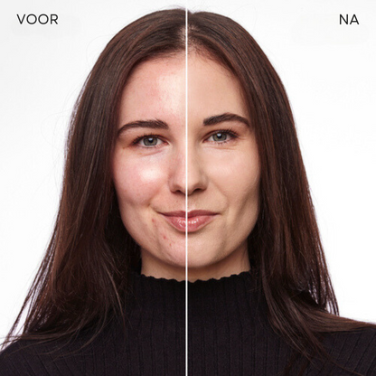 LuxeTone™ | Geen onrustige huid meer!