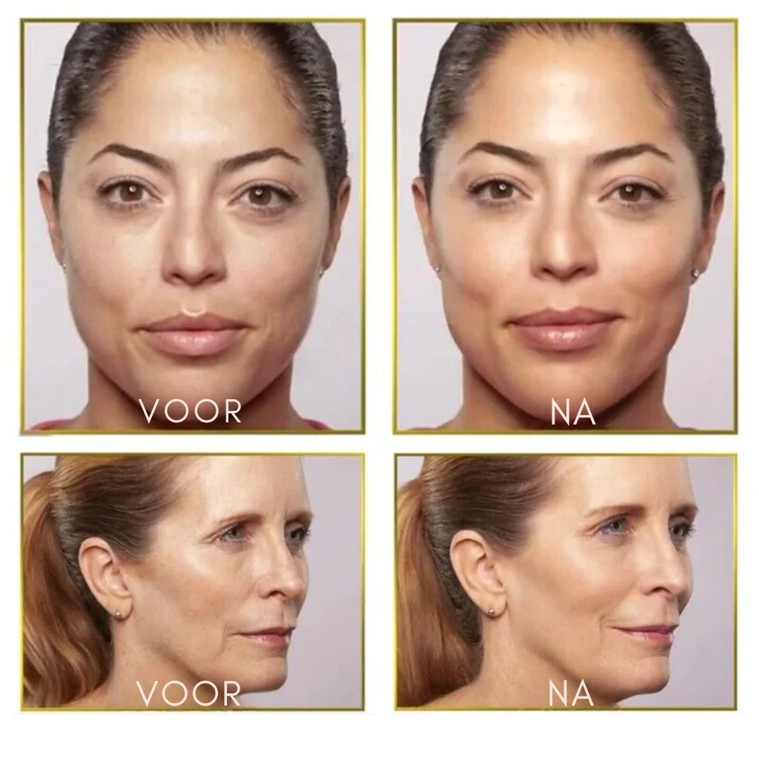 SonicSmooth™ | Altijd een stralende huid!