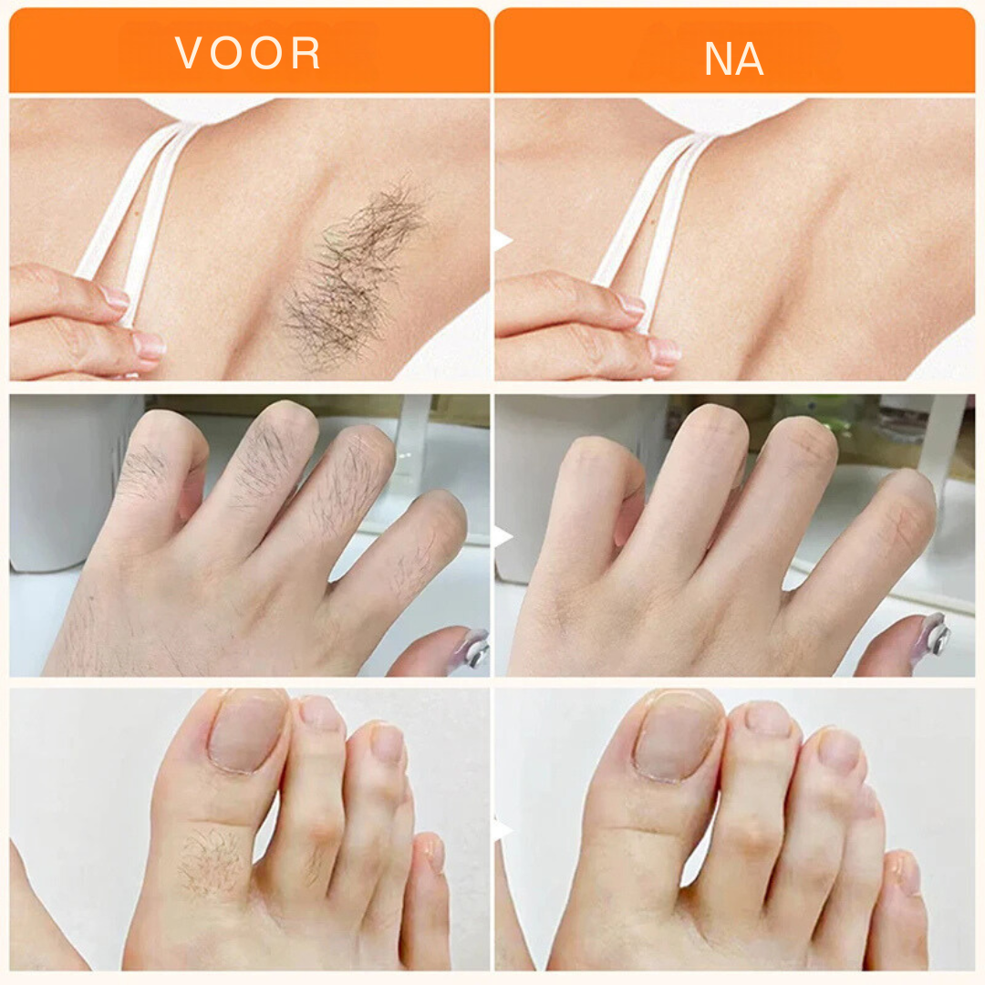 HairVanish™ | Verwijder snel ongewenste haren