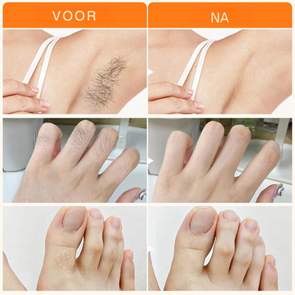 HairVanish™ | Verwijder snel ongewenste haren
