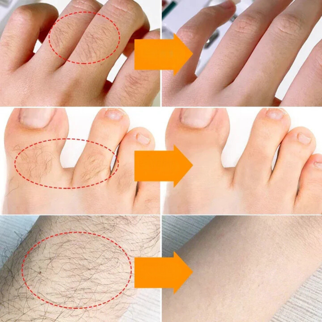 HairVanish™ | Verwijder snel ongewenste haren