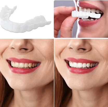 BrightSmile™ | Direct witte tanden!